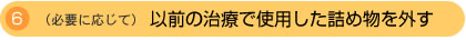 6.(必要に応じて)以前の治療で使用した詰め物を外す