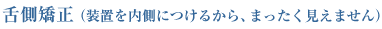舌側矯正(装置を内側につけるから、まったく見えません)