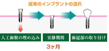 �]���̃C���v�����g�̗���