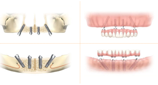 �p���i�}�j