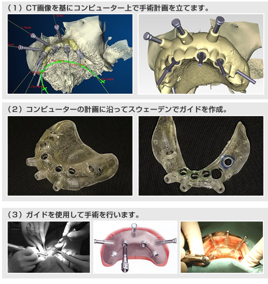 �R���s���[�^�K�C�h�V�X�e��