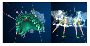 �Ö������Ö@