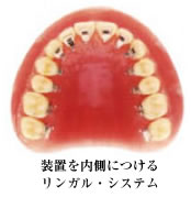 ���u������ɂ��郊���K���E�V�X�e��